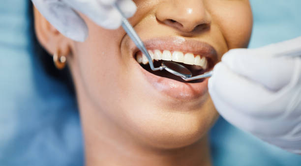 Best Emergency Broken Tooth Repair in Exton, PA